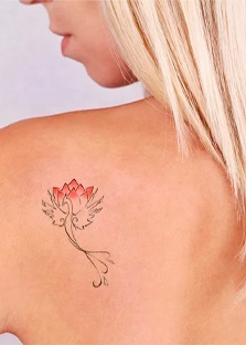 Remoção de Tatuagem